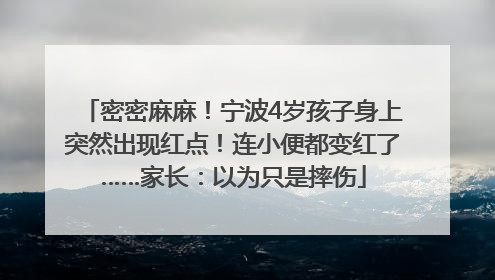 密密麻麻！宁波4岁孩子身上突然出现红点！连小便都变红了……家长：以为只是摔伤